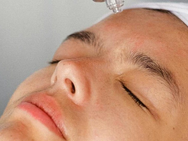 estética avanzada en terrassa